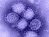 Migrant woman sixth case of swine flu in city