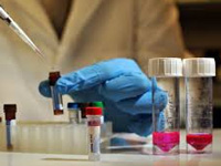 No lab facility may result in spread of swine flu B virus