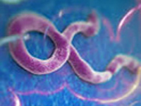Ebola to spread globally sans exit screening