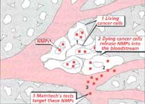 Tracking tumours