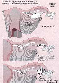 Fertility cold stored