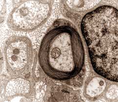 Film on the making of sensitive myelin sheaths